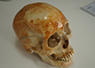 Three-dimensional skull detection、Three-dimensional detection of human skull