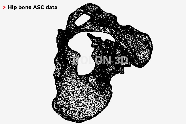 Hip bone ASC data