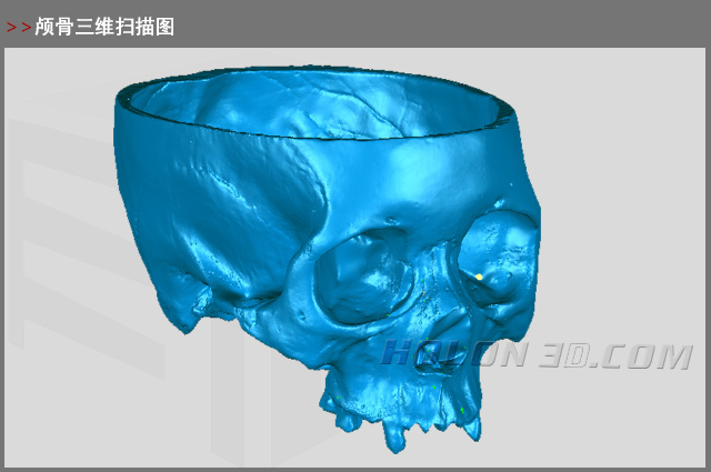 顱骨三維掃描圖