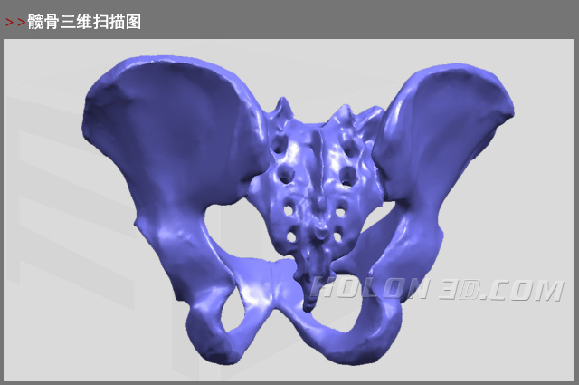 髖骨三維掃描圖