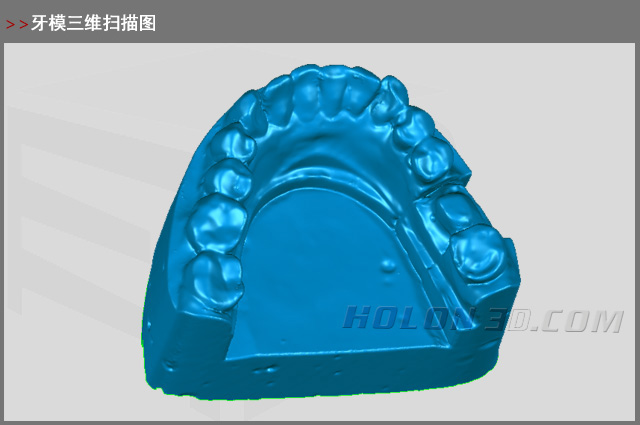 牙模三維掃描圖