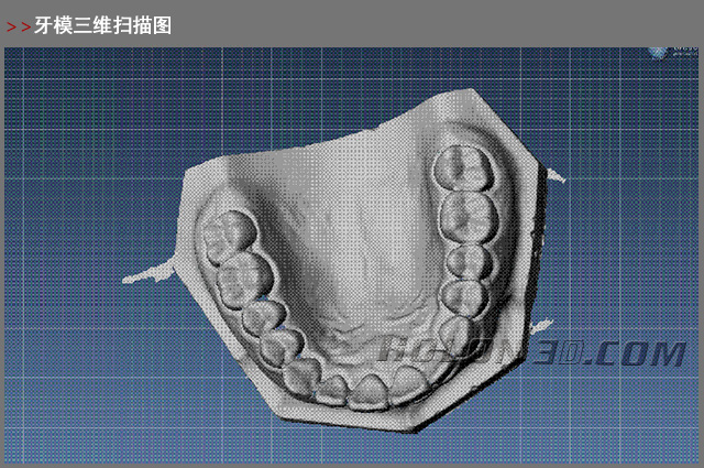 牙模三維掃描圖